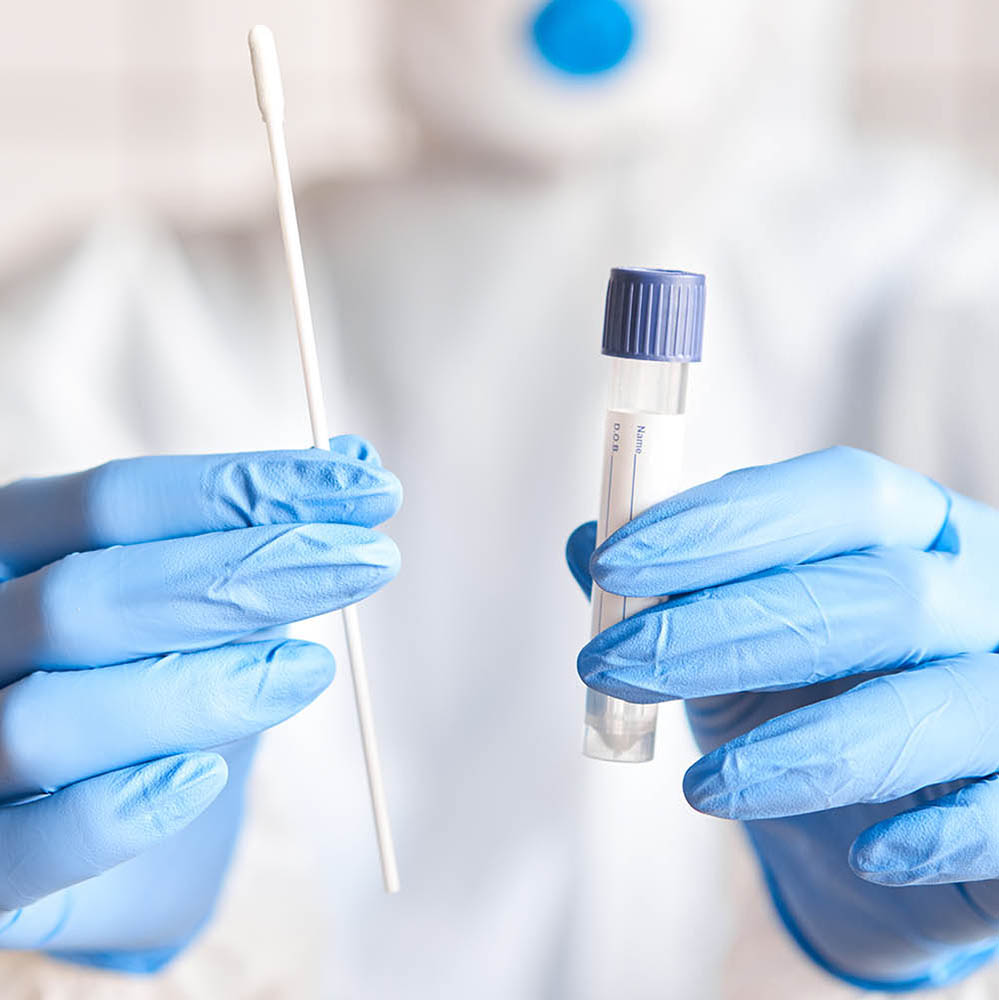 Doctor holding swab test tube for 2019-nCoV analyzing. Coronavirus test. Blue medical gloves and protective face mask for protection against covid-19 virus. Coronavirus and pandemic.